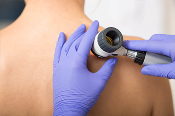 img-service-skin-cancer-screening
